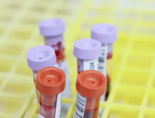 Tumor Markers Test