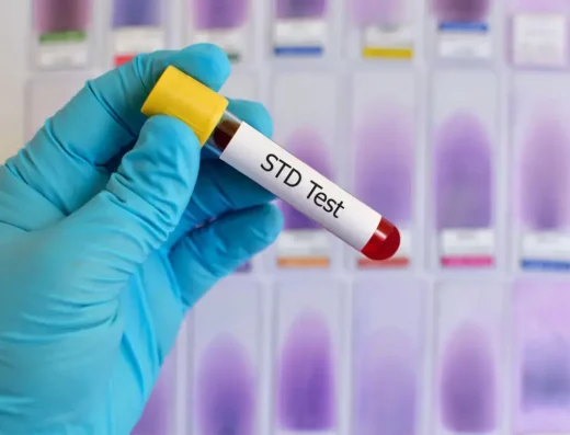 STD Check-Up