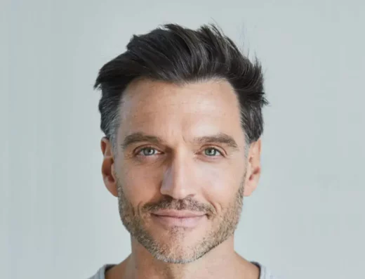 Fue hair transplantation