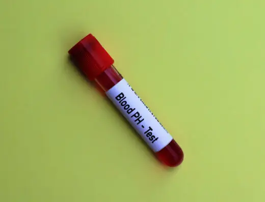 Oxidative Stress Blood Test