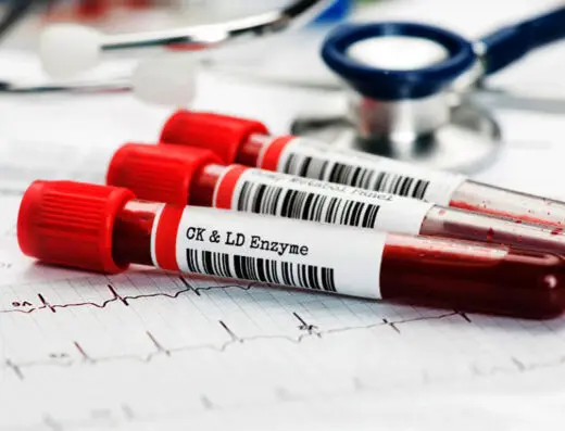 General Blood Test