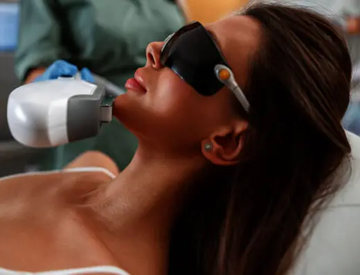 IPL Laser Treatment
