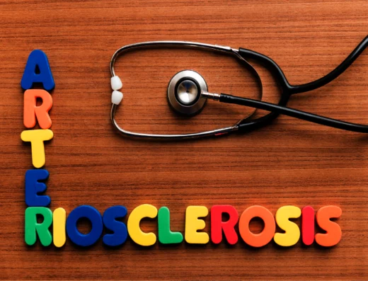 Arteriosclerosis Exam