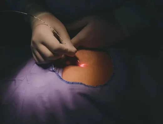 Hemorrhoid Treatment