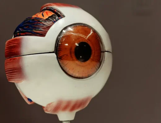 Implantable Contact Lens Surgery