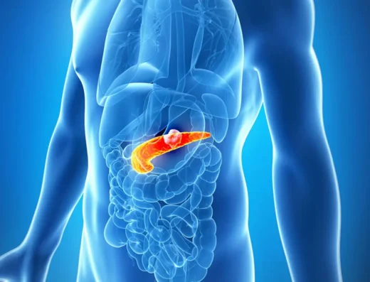 Pancreatic Cancer Treatment