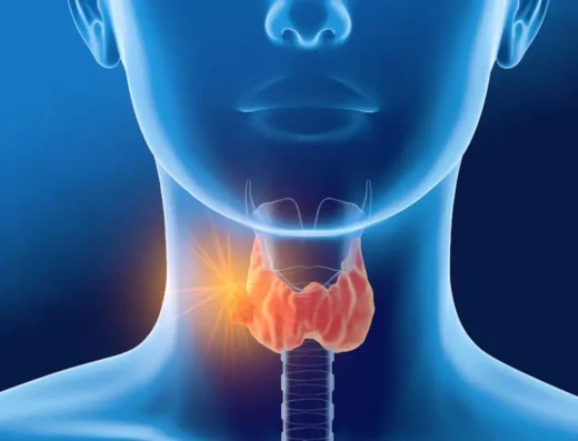 Transoral Endoscopic Thyroidectomy (TOETVA)