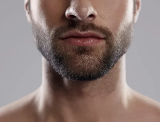 Beard Transplantation